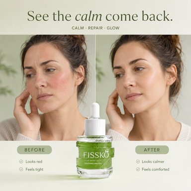 Redness Reset Serum